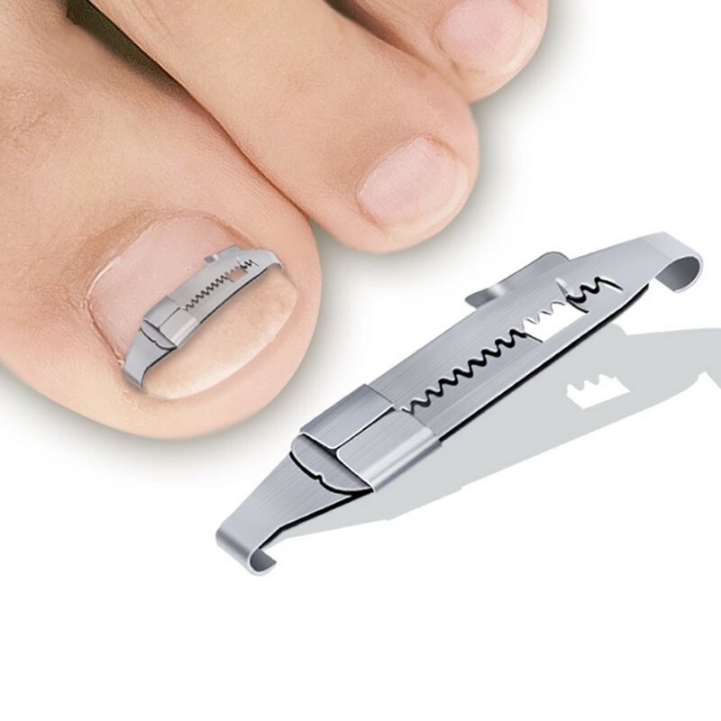 炭素鋼ペディキュアツール,足の爪をまっすぐにするためのツール,湾曲したクリップ,足の親指のサポート,足の親指の矯正