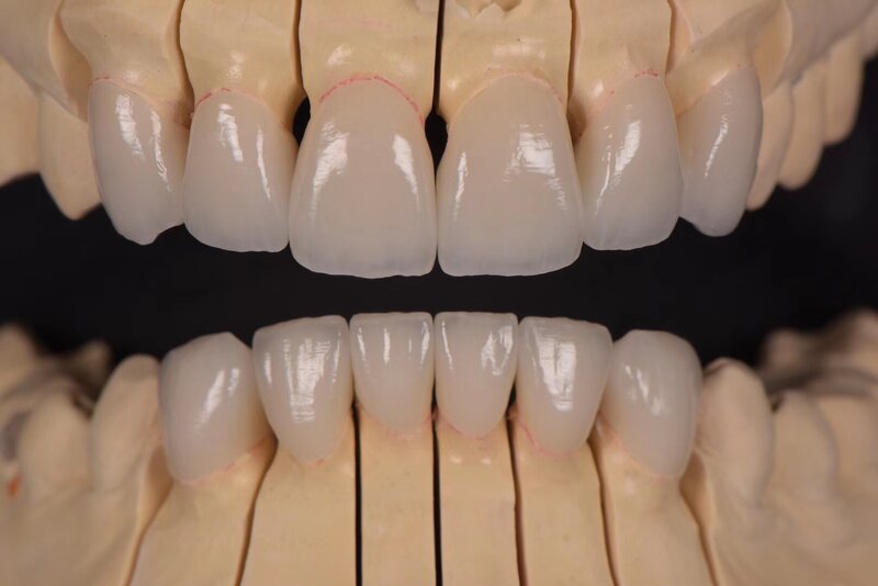 Bloco dental da zircônia do material do zircônio, Zirkon branco para CAD/CAM ST, Bloco Preshaded da zircônia, C3, cor D2