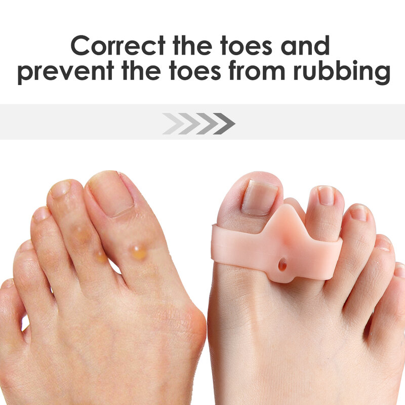 Corretor de hálux valgo de dedo do pé, 2 peças, separador de dedos dos pés para alívio da dor, ligação de polegar, estrutura ortopédica, pedicura