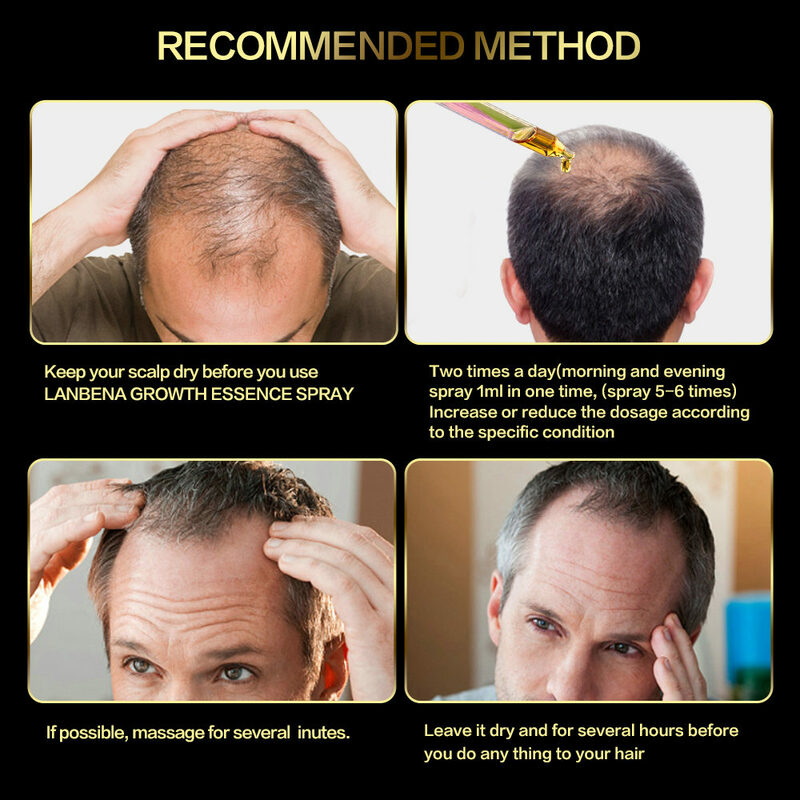 Produtos da perda de cabelo dos cuidados com os cabelos soluções tônicas para a perda de cabelo dos homens