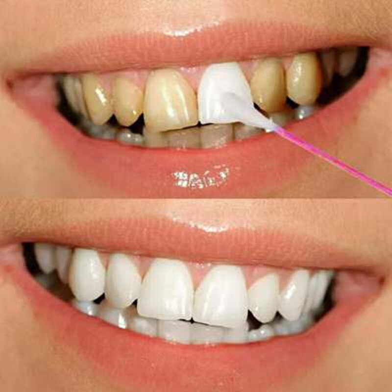 2pcs 허브 치아 미백 분말 구강 클렌징 위생 보통 세럼 제거 플라크 얼룩 항균 젤 치과 도구