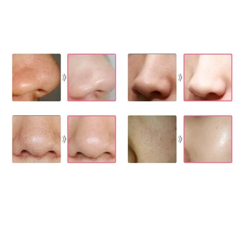 Dermabrazja diamentowa zasysanie próżniowe usuwająca zaskórniki twarzy próżniowe urządzenie oczyszczające pory przeciwtrądzikowe na nos środek usuwający pryszcze piękno oczyszczanie twarzy
