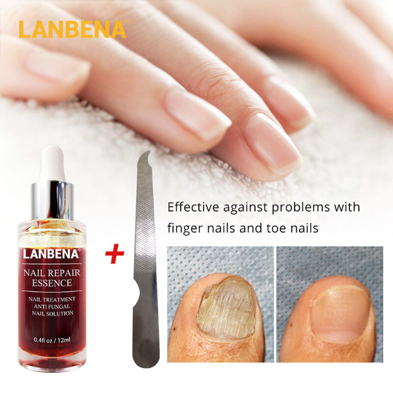 Creme de unhas labena toenail reparação para fungos lanbena contra onicomicose ferramenta para perna lambena antifúngico cogumelo