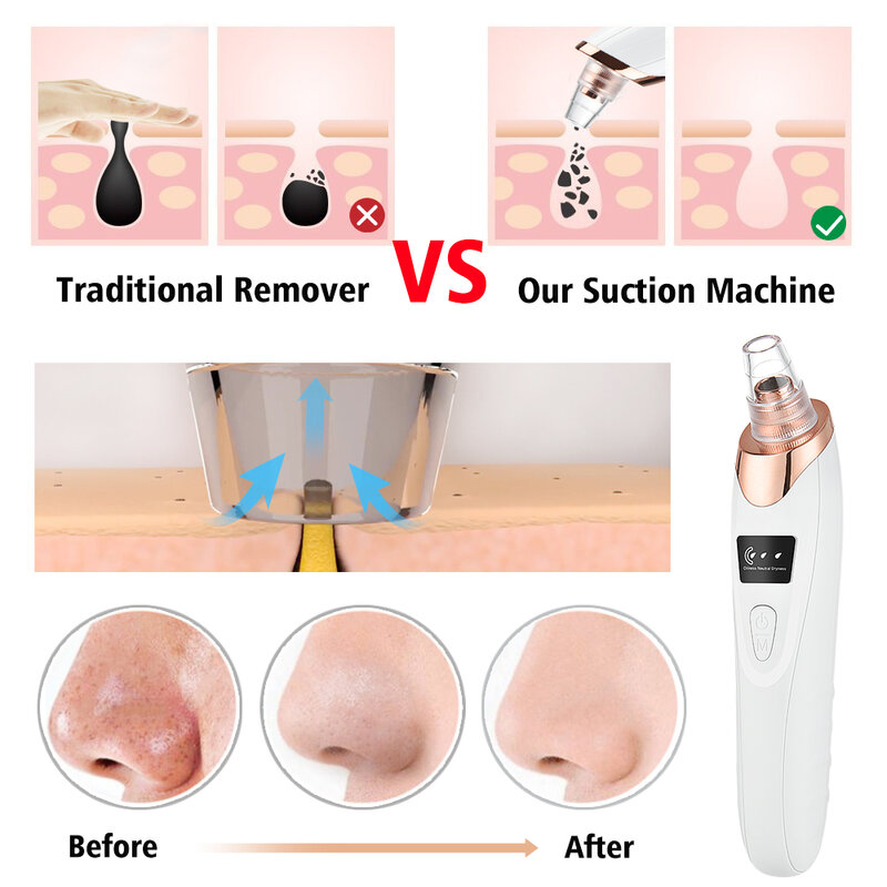 Blackhead Remover สูญญากาศ Pore Cleaner ทำความสะอาดจุดสีดำดูด Exfoliating ความงามสิวสิวสิว Remover Tool
