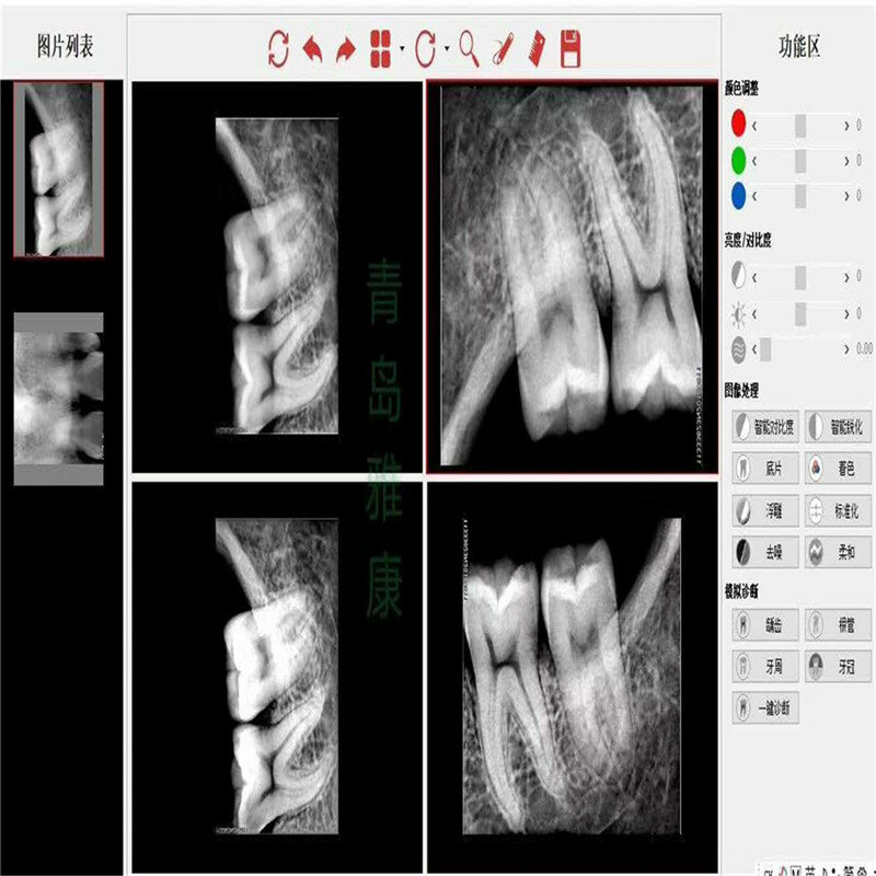 Удобный стоматологический рентгеновский Датчик HDR500, стоматологический рентгеновский Датчик RVG, подключение USB 2,0