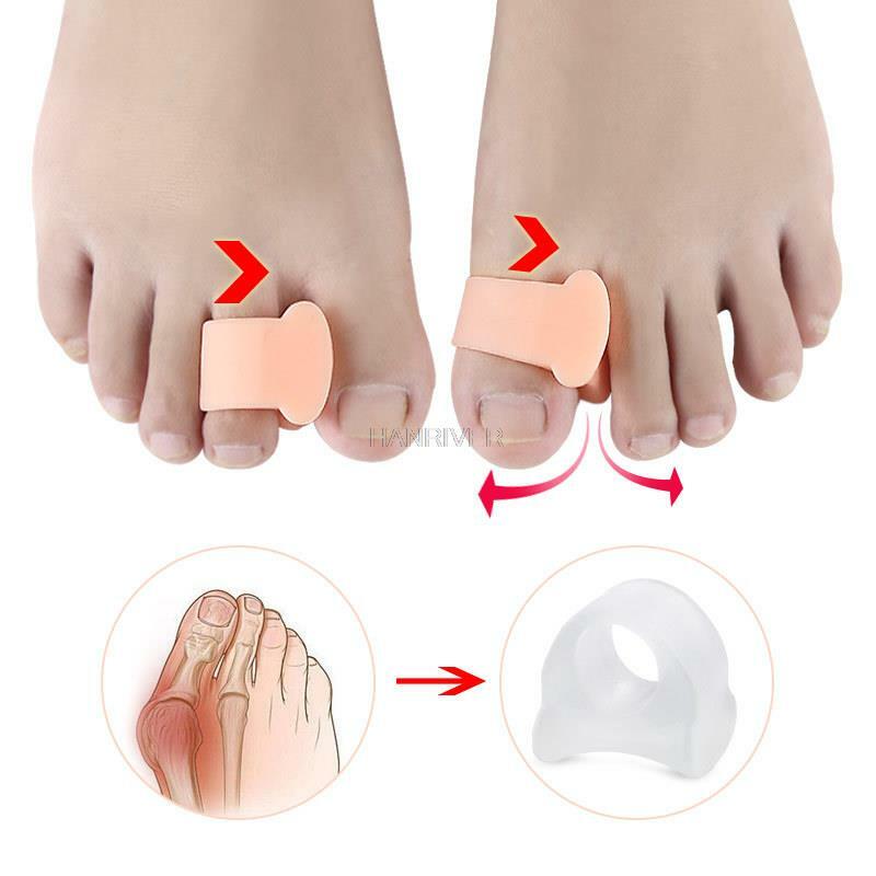 Ortopédicos para hálux valgo curvado, separador de dedos grandes, sobreposição de polegar, hálux valgo