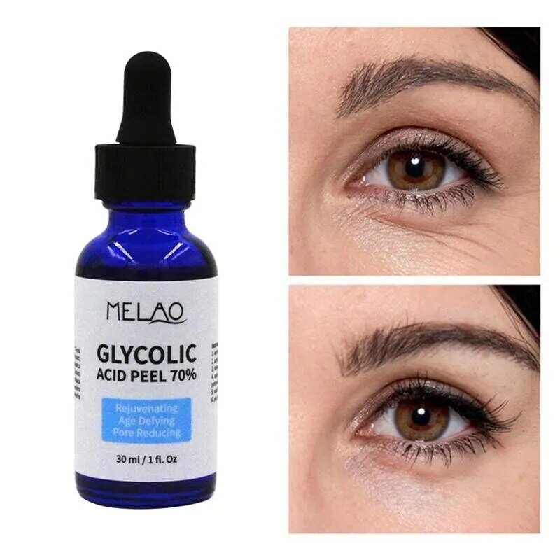 30ml Glycolic Acid Peel Repair Solution Shrink Pores Brighten Skin Color Balance Water And Oil Improve Acne Skin Nourishing Care