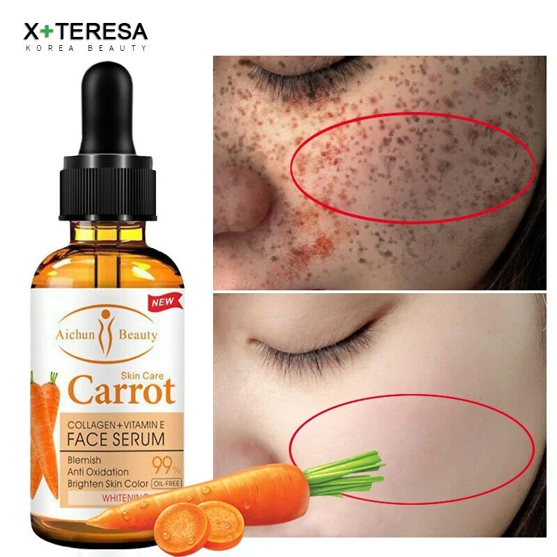 Dark Spot Correctorเซรั่มฟอกสีฟันเซรั่มBlemish Freckle RemoverธรรมชาติแครอทEssence Korea Skin Care