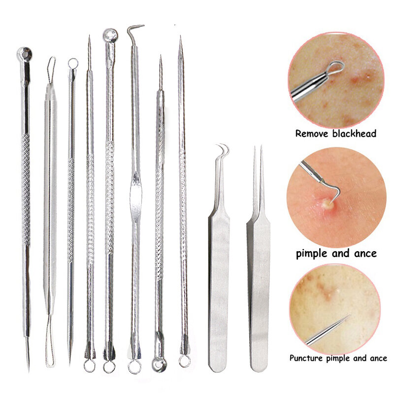 Removedor de cravos de espinhas preto, ferramenta de remoção de cravos, agulhas para espremer, ferramentas de acne, colher para limpeza do rosto, extrator de comedão, limpador de poros