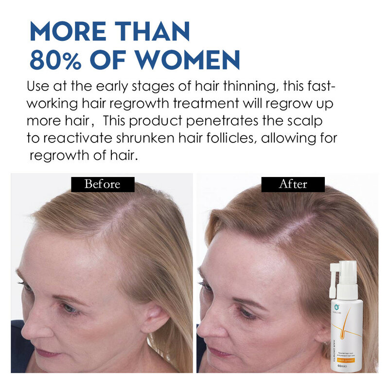HAIRCUBE Hair Growth ผลิตภัณฑ์ Essence น้ำมัน Hair Care Treatment Hair Growth Serum Anti Hair Loss Beauty ผลิตภัณฑ์