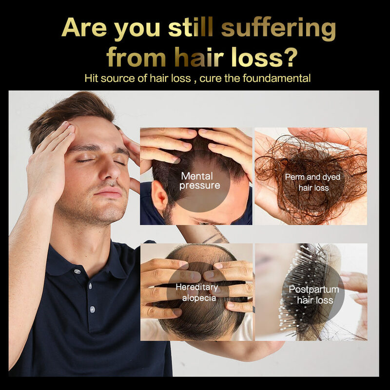 Produtos da perda de cabelo dos cuidados com os cabelos soluções tônicas para a perda de cabelo dos homens