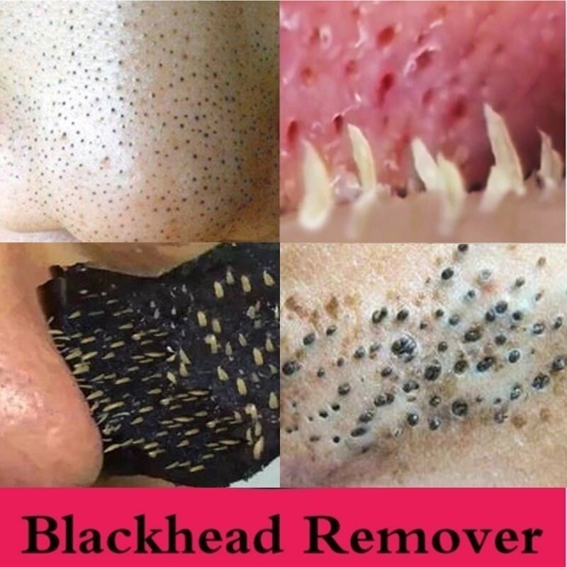 15 pièces nouveau point noir acné nettoyage en profondeur bambou charbon de bois minéral nez masque Pores pelables beauté nettoyage