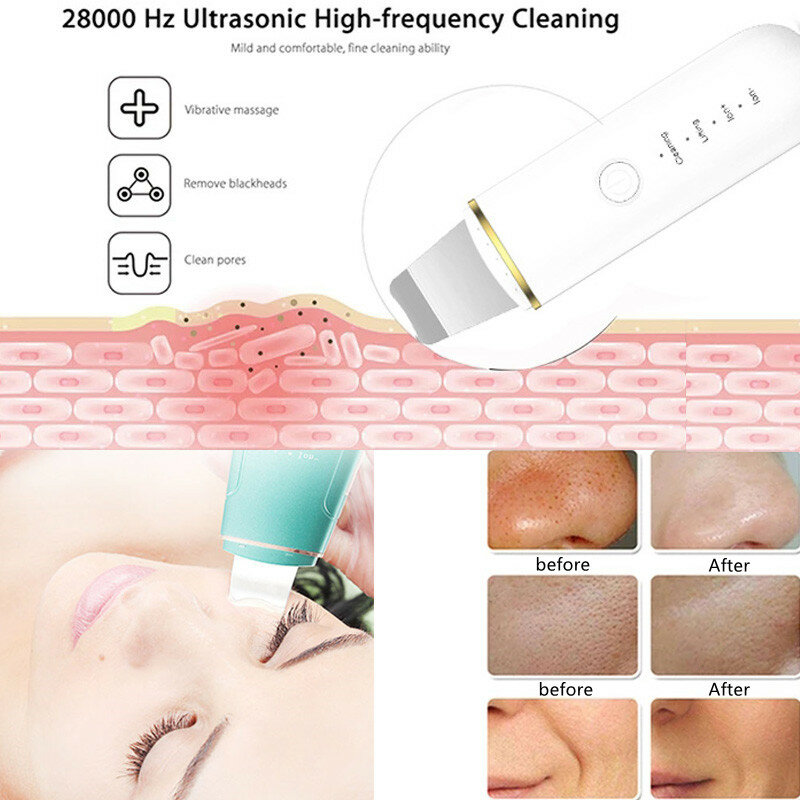 LORAPO Ultrasonic Skin Scrubber Deep Face Cleaning Blackhead Remover Facial Scrubber Shovel Vibration Face Spatula Lift Machine