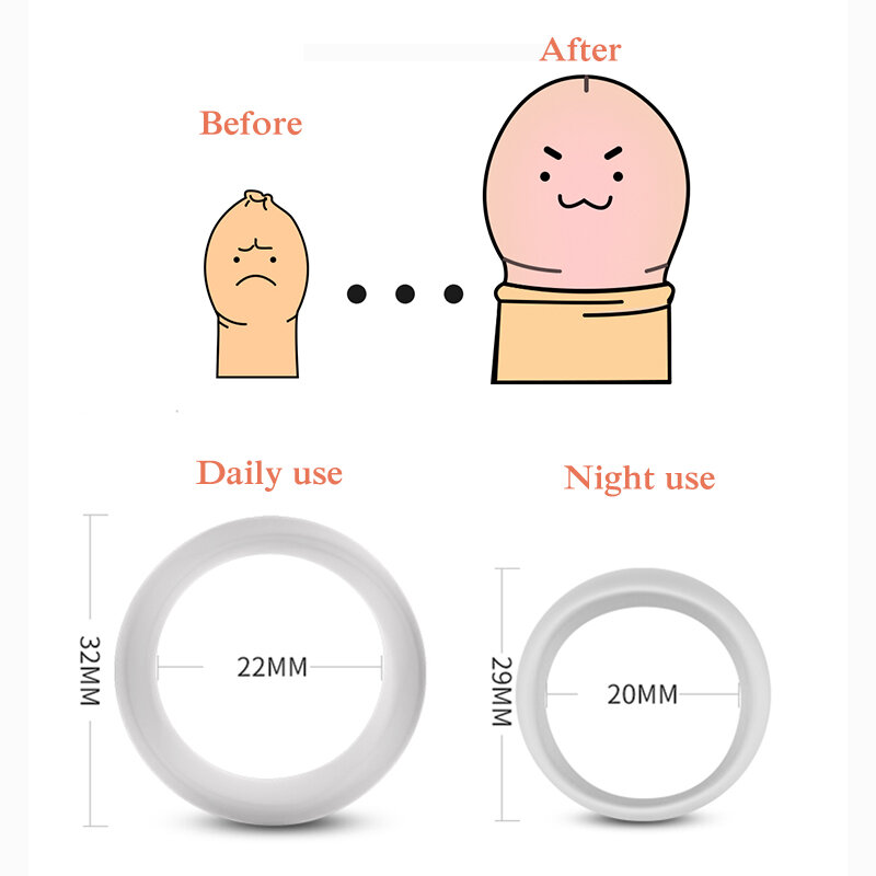2 pçs silicone masculino preeskin corrector anel de resistência atraso ejaculação pênis anéis sexo brinquedos para homem diário/noite galo anel
