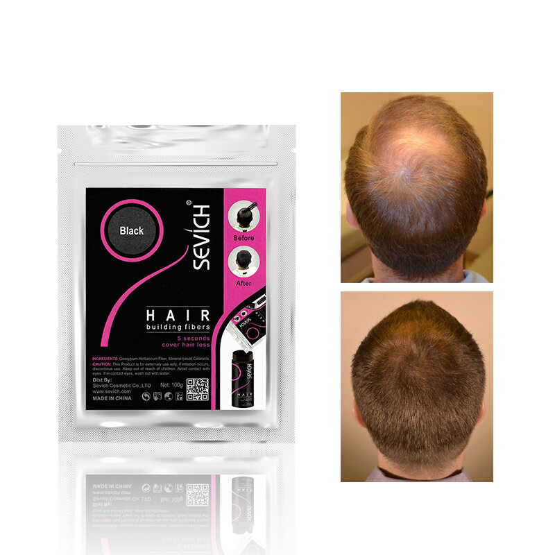 Sevich 100g 10 colori cheratina perdita di capelli costruzione fibra crescita dei capelli fibra ricarica perdita di capelli correttore frullatore 50g prodotto per la cura dei capelli