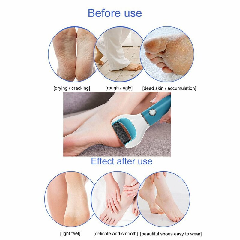 Electric Pedicure Tools Sets File Vacuum Callus Remover Dead Skin Callus Remover Foot Files Foot Care Tools