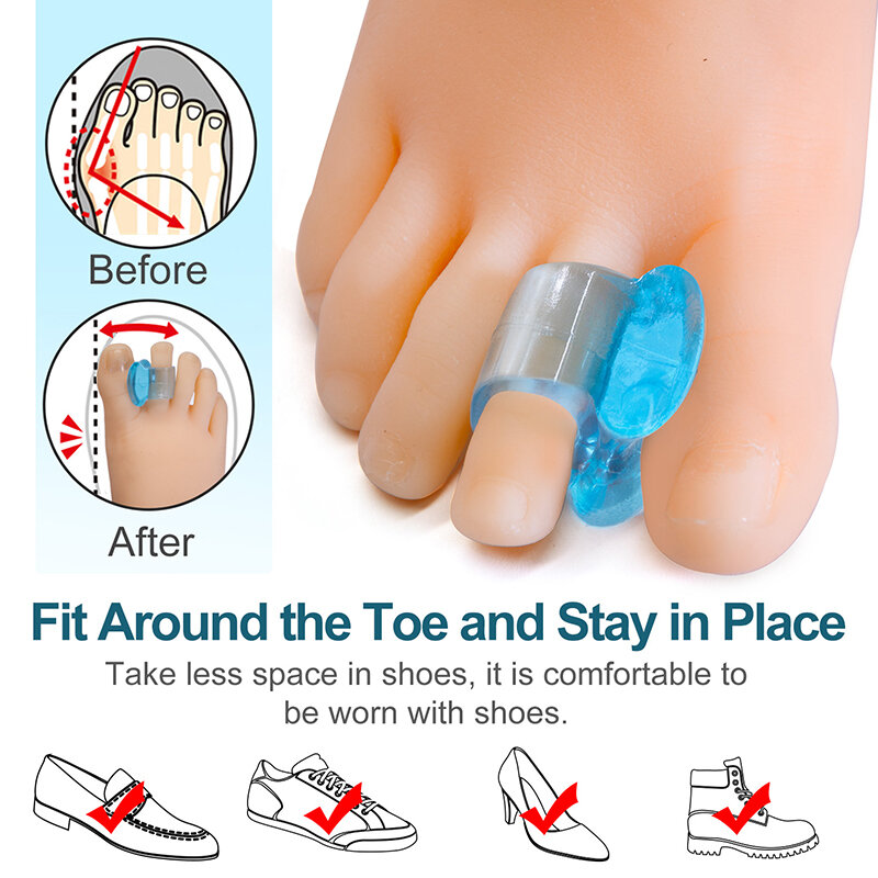 Separador de dedos de Gel de silicona suave azul, separador de juanetes Hallux Valgus, Corrector de pulgar, herramienta para el cuidado de los pies, 2 piezas, C1708
