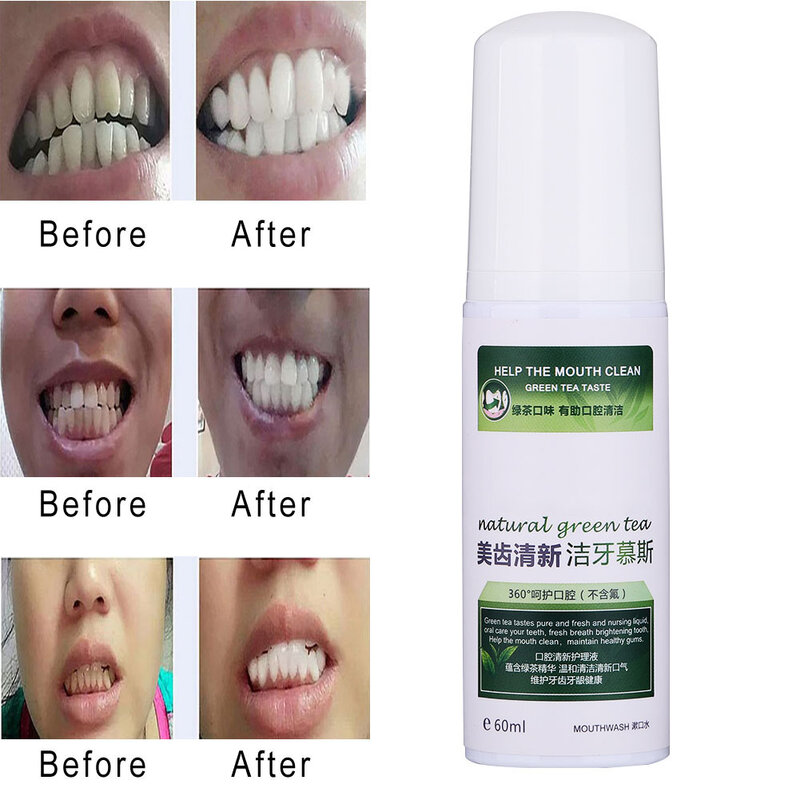 60ml dentes de limpeza de espuma limpador solução de remoção de tártaro respiração fresca cuidados orais