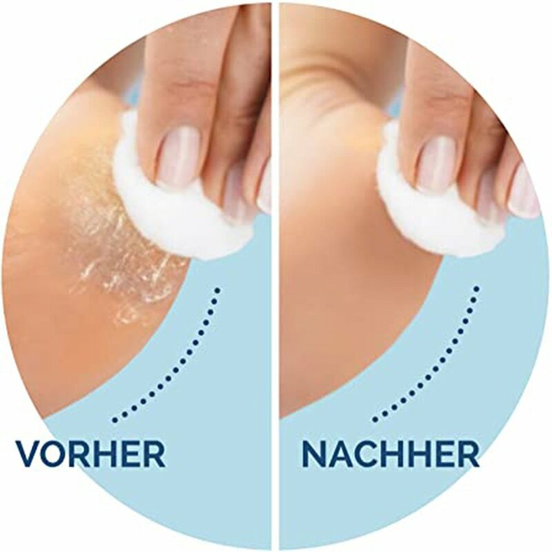1 Stück Fußpflege-Werkzeug köpfe Pedi-Hart haute nt ferner füllt Ersatz rollen für Scholls-Feilen-Fußpflege tool nach