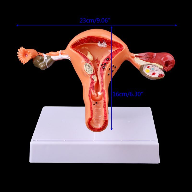 Accesorios médicos modelo gastos de envío gratis uterino patológico ovario modelo anatómico anatomía sección transversal herramienta de estudio