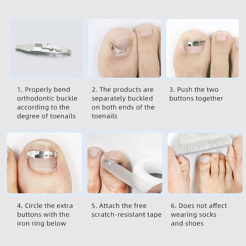 Herramienta de pedicura de acero al carbono para uñas encarnadas, Clip de corrección alisadora, corrector de paroniquia gruesa
