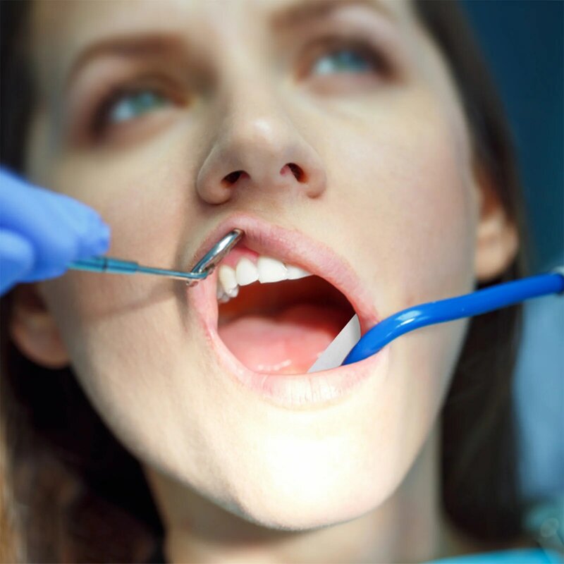 250 Stuks Gerolde Katoenen Tandheelkundige Benodigdheden Tandarts Cottons Pads Verpleegneus Bloedende Pluggen Met Stollingsmiddel