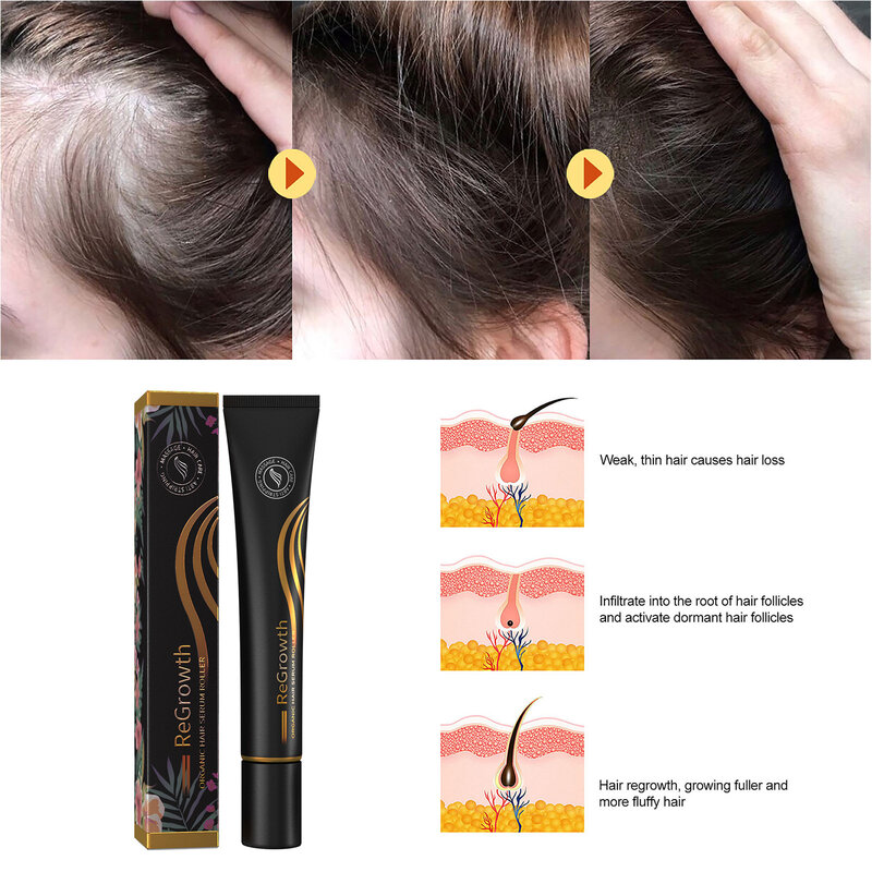 Roller Ball Regrowth Hair Serum Massage Scalp Anti-Fall Hair Liquid Improve Hair Strength Biotin Hair Growth Serum Essence