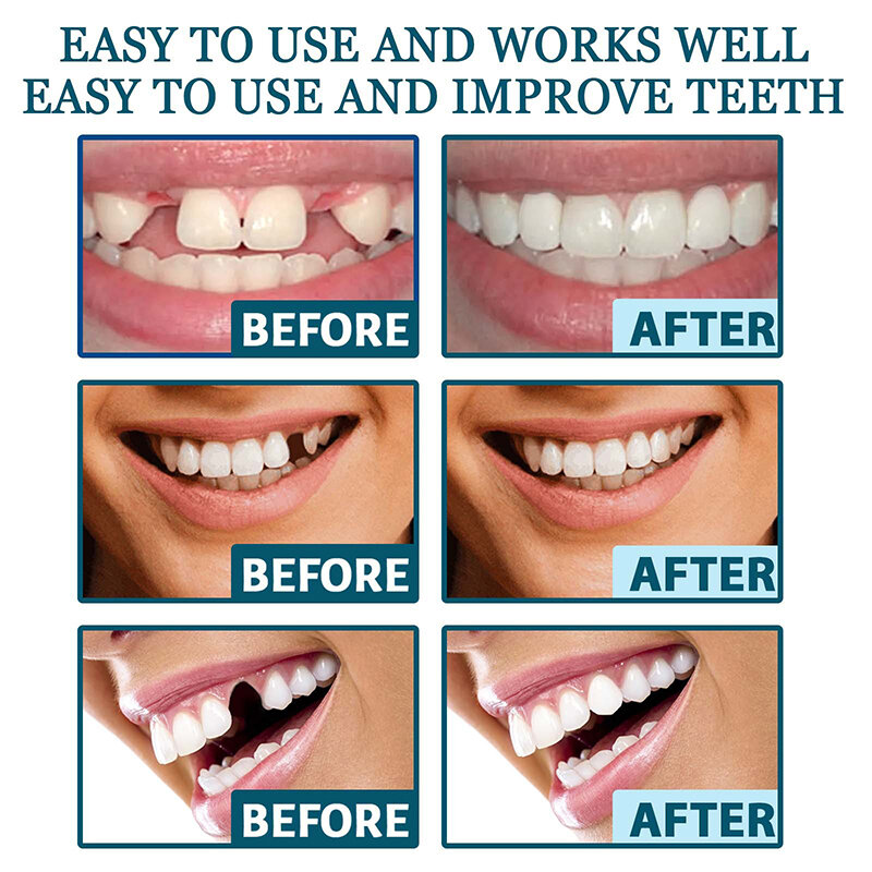 Регулируемый набор зубных протезов, мгновенный улыбающийся шпон, отбеливающие зубы, натуральные портативные зубные скобы, украшают зазоры между зубами