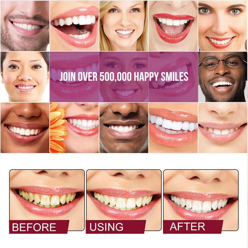 Tandpasta Gevoelige Tanden En Holtebescherming Reparatie Van Holtes Cariës Verwijdering Tandplak Vlekken Verval Vergelende Tanden Bleken