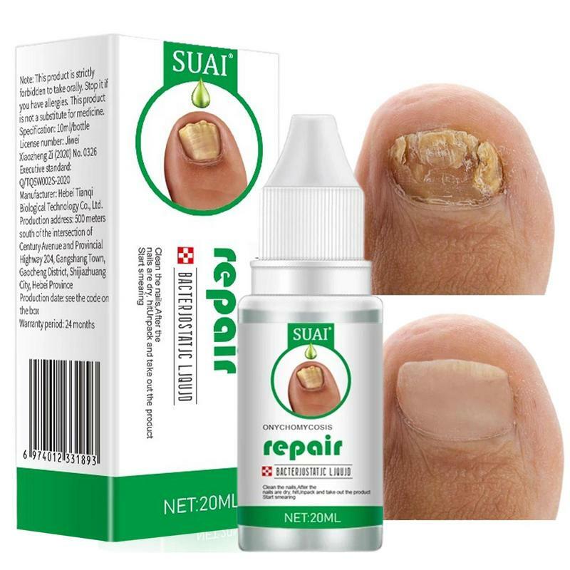 Toe Nail Strengthener And Growth Formula Treat & Eliminate Nail Renew Essence Nail Clarifying Nail Solution For Discolored Nails