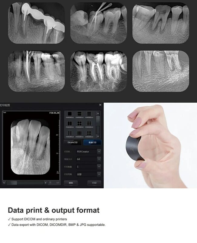 Fussen Dental Oral Imaging Plate Smart Sensing Processing macchina Scanner per scansione di immagini a raggi X ad alta definizione