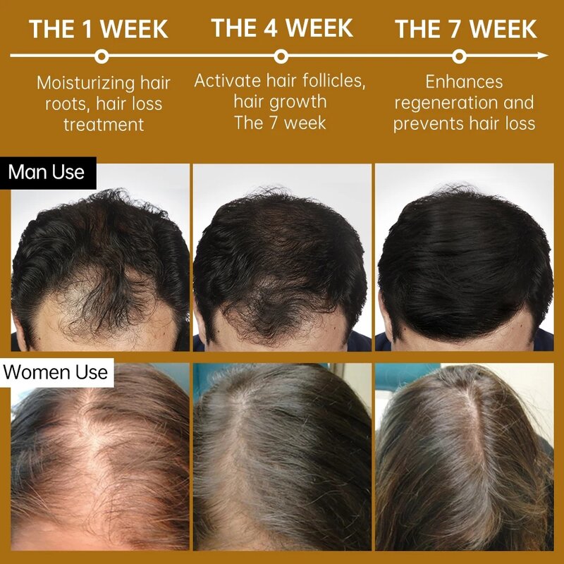 Женьшень утолщенный шампунь для роста волос Продукты для мужчин и женщин имбирь для необходимой потери волос лечение кожи головы косметический уход за волосами