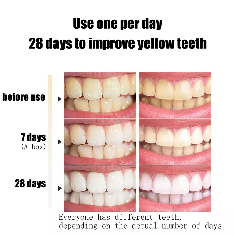 Zahn aufhellung Essenz saubere Mundhygiene Zahn aufhellung entfernen Plaque Flecken frischen Atem Mundhygiene Mundpflege Zahnpflege Set