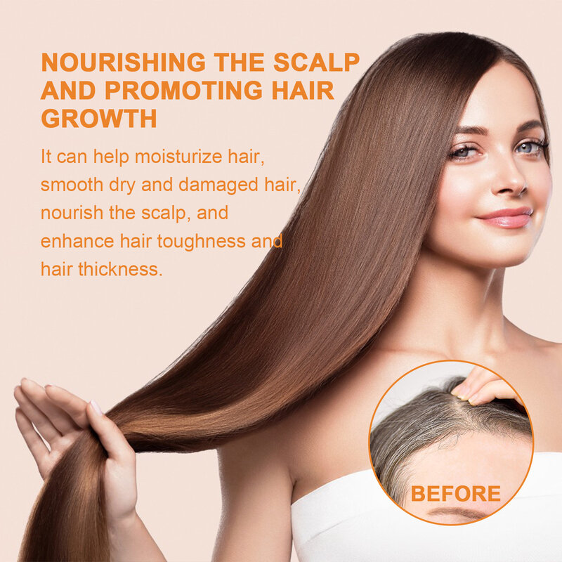 Aceite para el crecimiento del cabello, tratamiento del cuero cabelludo, reparación de calvicie, antipérdida de cabello, antienvejecimiento, Alopecia, adelgazamiento, reafirmante, suero para el cuidado del cabello de la piel