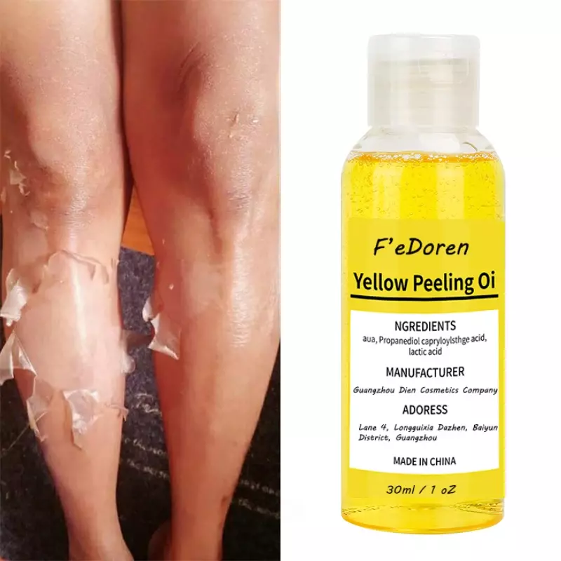 30/50Ml Thai สีเหลือง Peeling น้ำมันฟอกผิว Retinol Peptide จุดด่างดำ Blackheads สิว Bad Skin Spot treatment