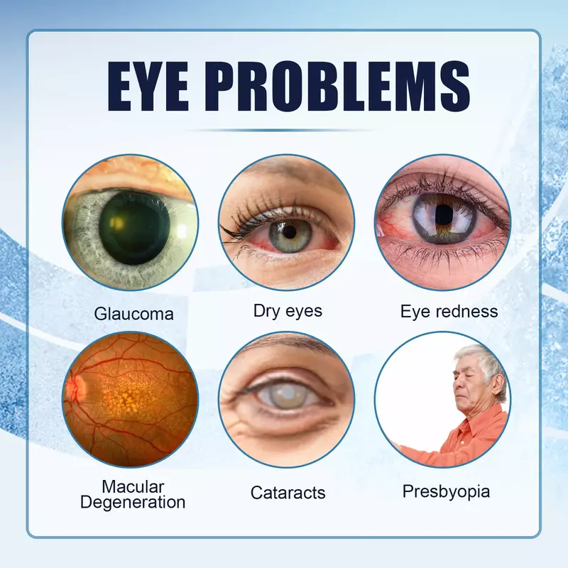 Tetesan mata untuk glasioma presbiopia mata merah kering kelelahan Visual meningkatkan penglihatan yang lebih baik memutihkan lensa cairan Perawatan Mata