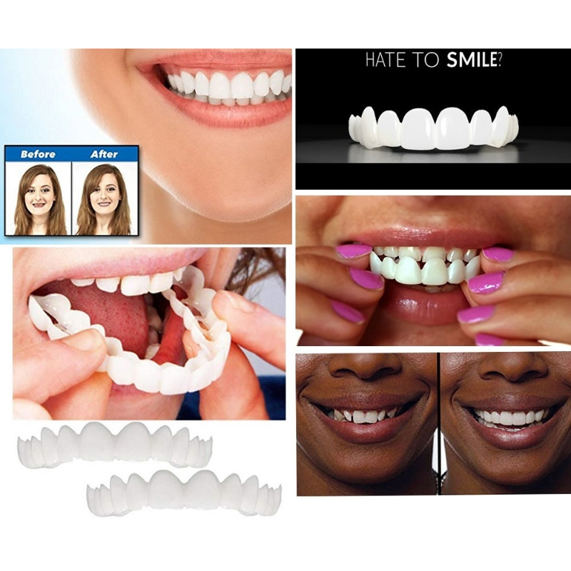 Placages de dents supérieurs et inférieurs, accolades anti-vraies, dents de prothèse de blanchiment des dents en polaire à encliqueter, dents de couverture de placage confortables