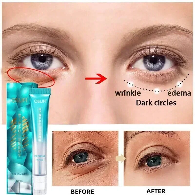 Eye Cream Reduces Dark Circles Tightens Skin Moisturizes Skin Massages Essence Korean Skin Care Cosmetics
