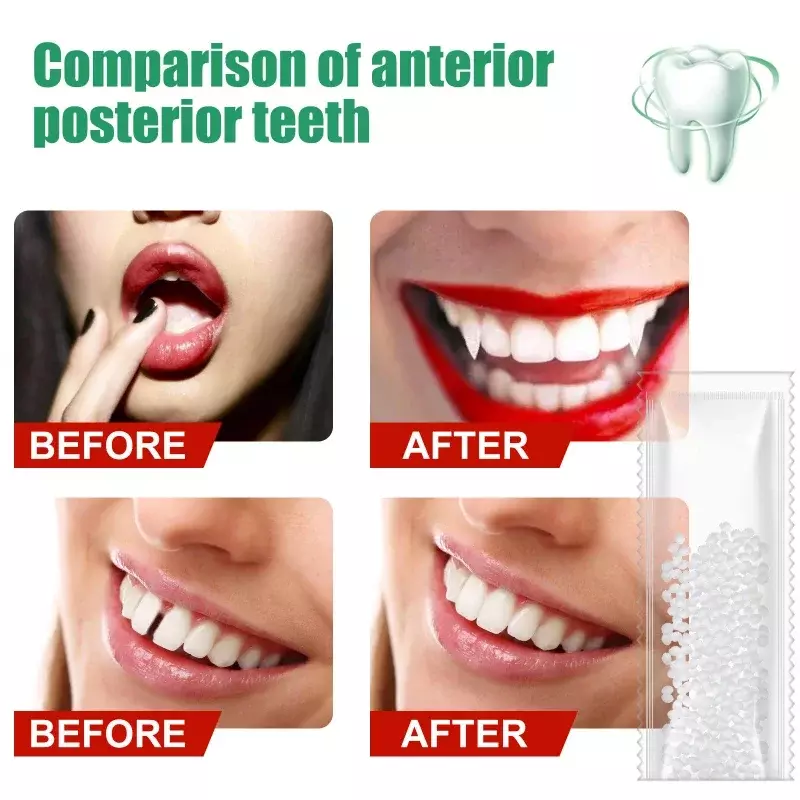 Dente Temporário Reparação Cola Sólida, Dentes Gap Repair Kit, Dentes Falsos Reparação, Segurança Dental Suprimentos, Dentes Clarear Ferramenta