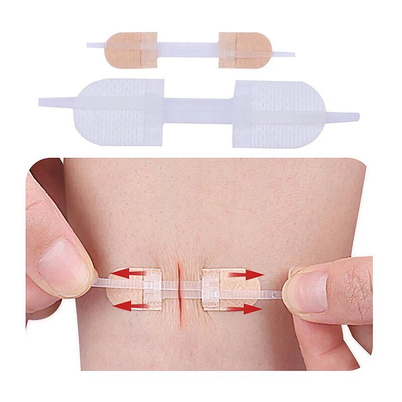 Zipper Tie Wound Encerramento Hemostatic Patch, Sutura Rápida, Band-Aid portátil ao ar livre de primeiros socorros, 3pcs
