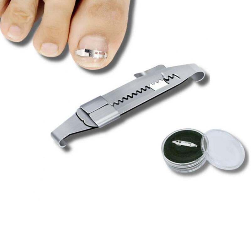 Corrector de uñas encarnadas, herramienta profesional para el cuidado de los pies, pedicura, recuperación de uñas encarnadas