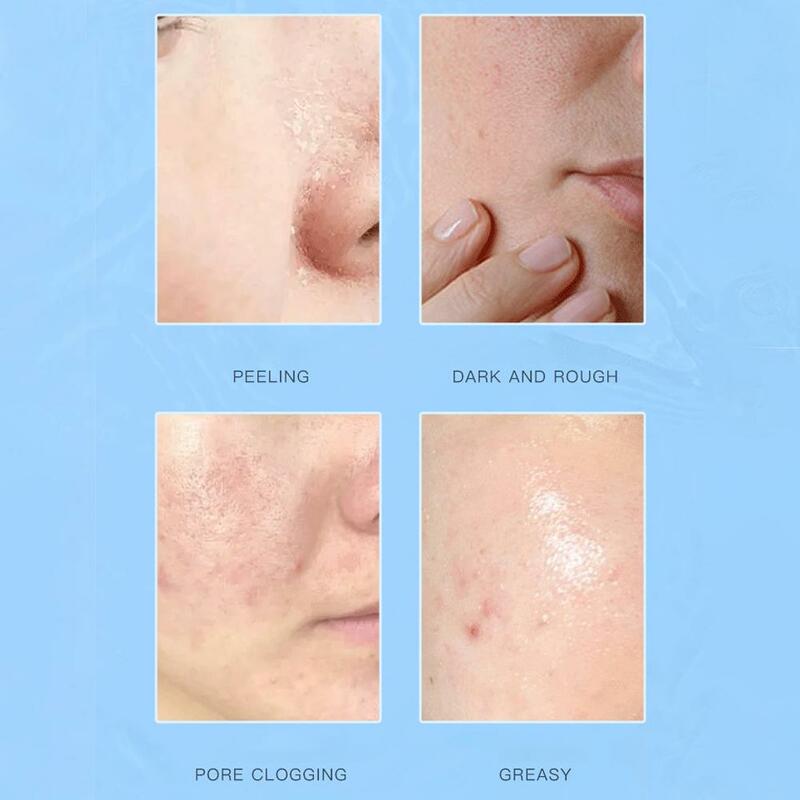 250ml beruhigender Toner Bio beruhigende erfrischende Toner poren abgestorbene Haut entfernen enge Kosmetika befeuchten e1o7