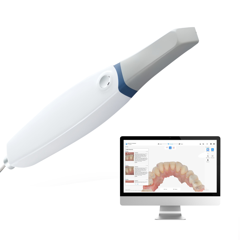 Runyes-IOS-11 Digital Dental Intraoral Scanner Portátil Portátil, Relatórios de impressão de suporte, 3D X-Ray Scanner para Laboratório Dental