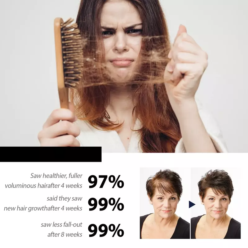 Couro cabeludo Shampoo Nutritivo Cabelo Regrowth, coceira Caspa Tratamento, removedor, Purificante Oil Control, o crescimento rápido do cabelo
