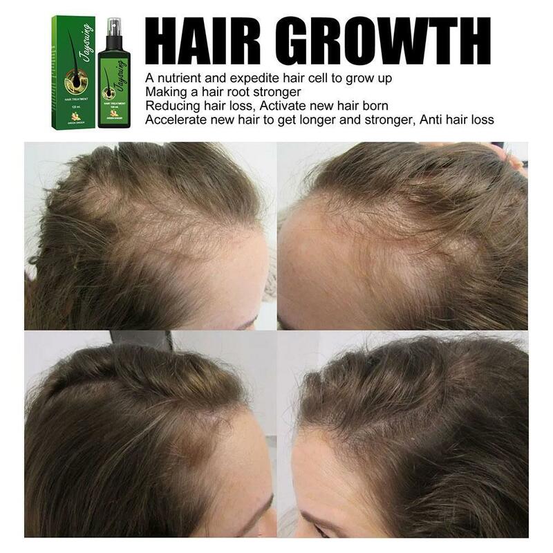 Herbal Hairrenascer Spray para homens e mulheres, Soro de óleo de gengibre nutritivo, Promover crescer rapidamente produtos grossos, D8T3