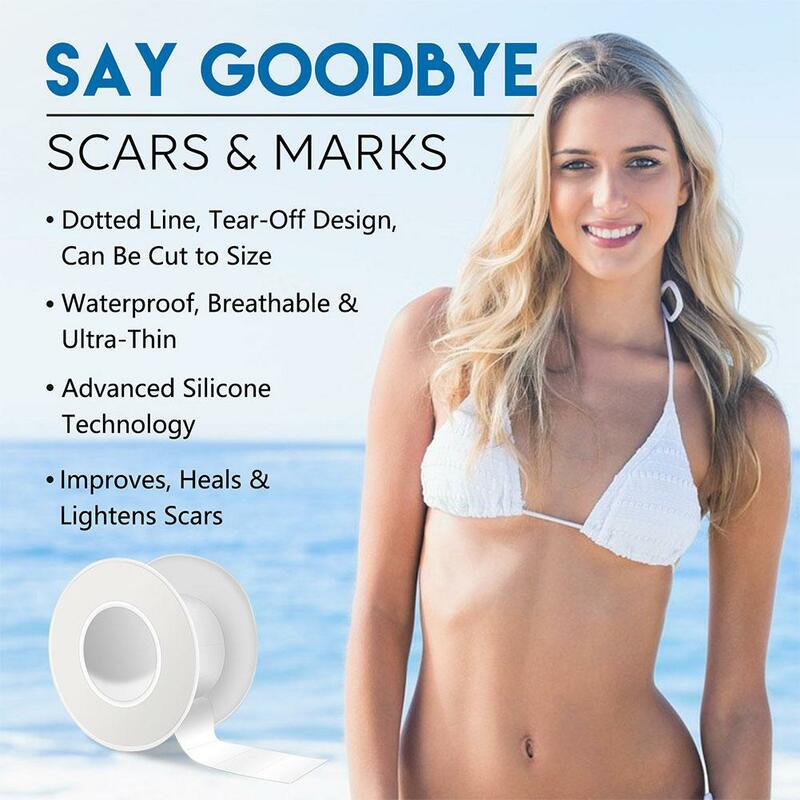 150cm Silicone Gel Scar Sheet Patch Treatment Removal Beauty Section Ear Acne Skin Cover Repair Tape Burn Trauma Scar U3I1
