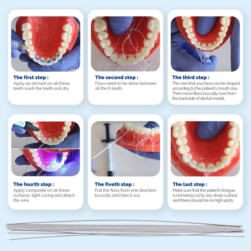 AZDENT-Fio de aço inoxidável para ortodontia, lingual redutor, fios torção reta, materiais de odontologia, plana, 150mm, 10pcs por pacote