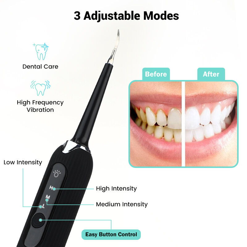 Elétrico ultra-sônico vibração dente cálculo removedor, sônico dental scaler, alta freqüência, manchas de dente, dentes limpador