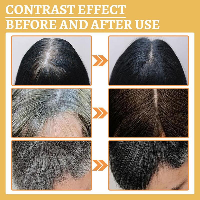 Aceite para reparar el cabello negro de blanco a negro, loción hidratante nutritiva para el cuero cabelludo, reparación líquida a base de hierbas, Antifrizz