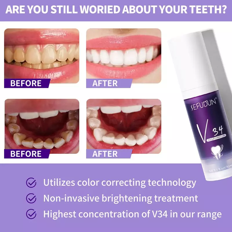 Gigi pemutih pasta gigi V34 warna koreksi gigi pemutih gigi ungu non-invasif pasta gigi pemutih